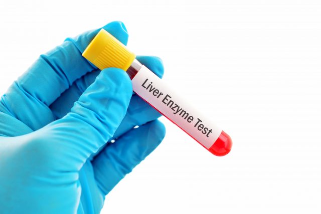 what-does-slightly-elevated-liver-enzymes-mean