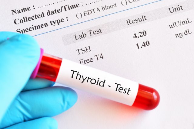 Should I Take Thyroid Medicine Before Blood Test 